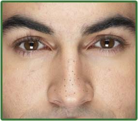 Image result for blackheads men