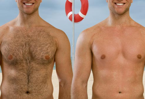 Variety of Methods to Remove Excess Hair for Men
